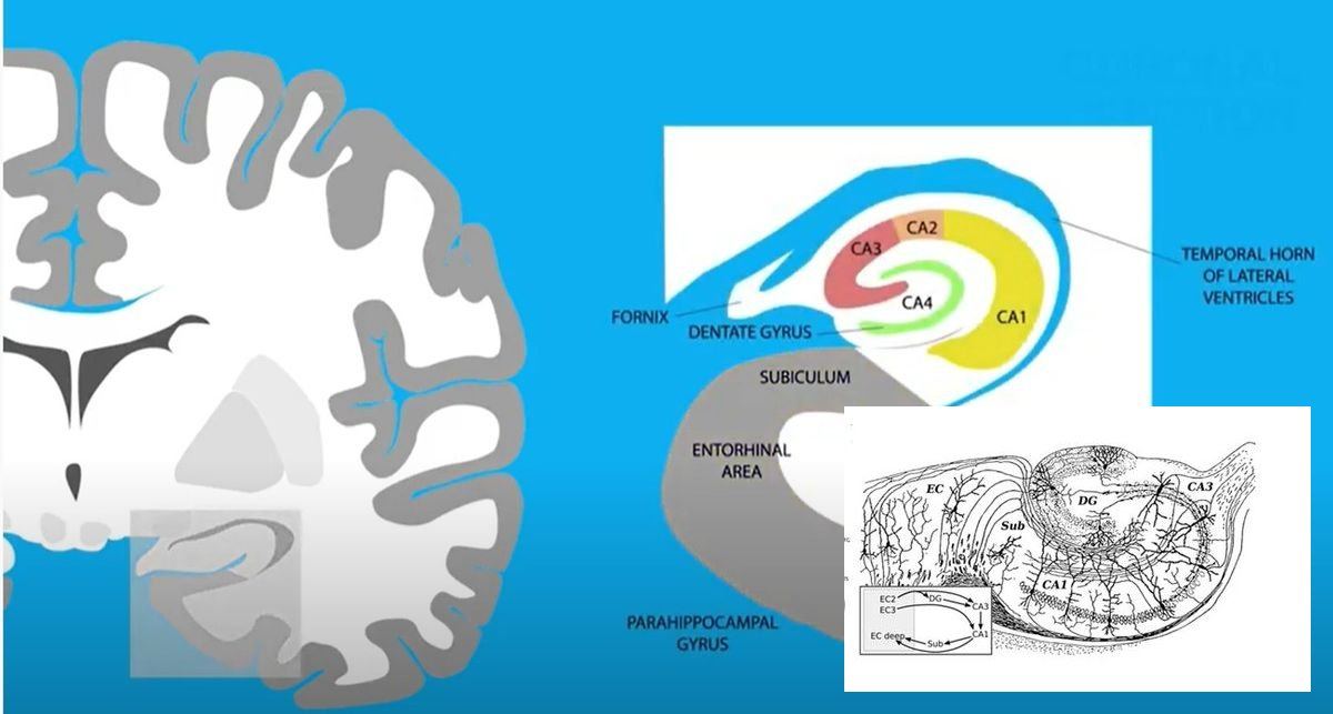 Hippocampus Cross-Section with Circuit Diagram